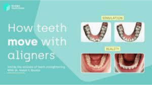 How to make clear aligners
